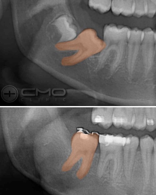 Curso de Residência em Ortodontia Clínica